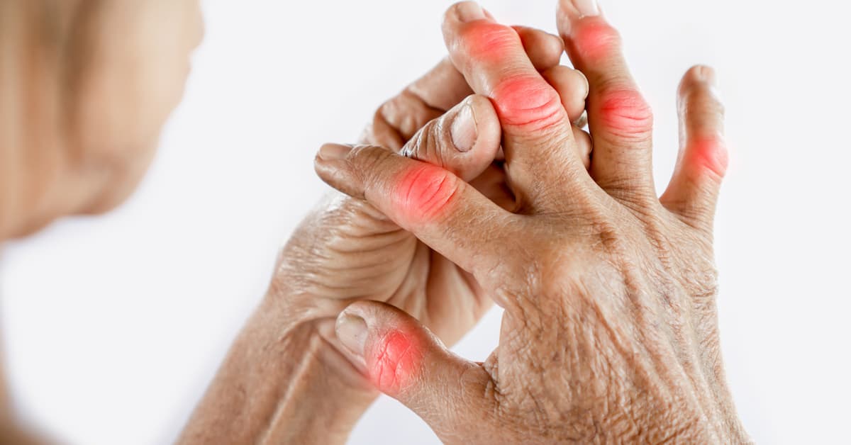 arthritis diagnosis boise